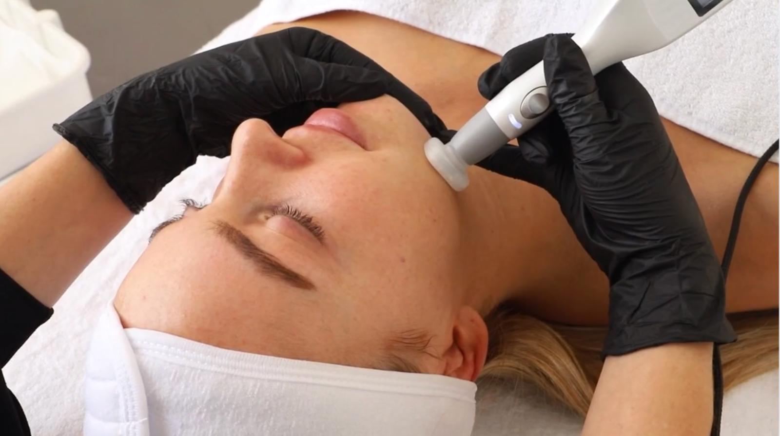 Jet Plasma: The Treatment that Tightens, Brightens, & Restores